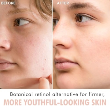 Bio Retinol Alternative Bakuchiol Serum for Youthful Skin