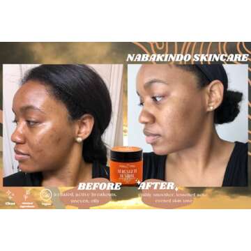 Nabak1ndo Serengeti Sunrise Face and Body Moisturizer Skincare | Ideal for Sensitive Skin and Eczema 2oz