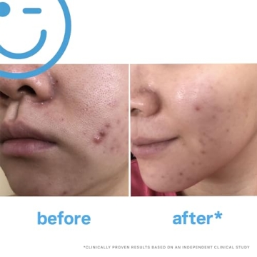 EradiKate 3% Sulfur Foaming Cleanser for Clear Skin