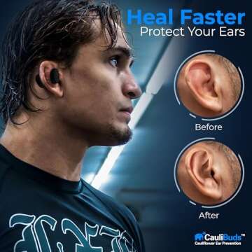 CauliBuds™ Cauliflower Ear Magnets - Premium Silicone Magnet Compression Kit for Cauliflower Ear Prevention & Treatment in BJJ, Wrestling, MMA, & Rugby - Minimize Ear Draining (Black)