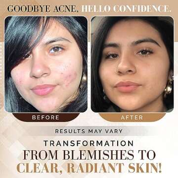 Noir D'or Acne Scar Treatment for Dark Spots & Breakouts