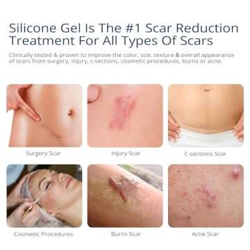 100% Silicone Scar Gel Scar Cream - Advanced Scar Gel for Surgical Scars, C-Section, Stretch Marks, ...