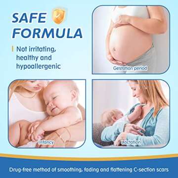 LONNIELONLI Silicone Scar Sheets for Effective Scar Healing