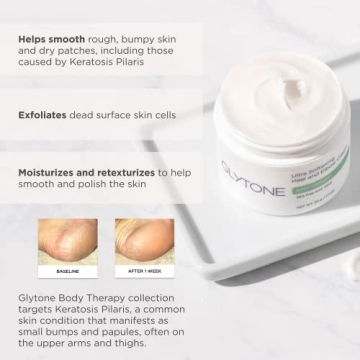 Glytone Ultra Softening Heel & Elbow Cream for Smooth Skin