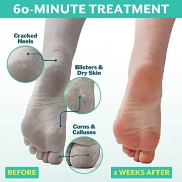 Patchology PoshPeel Pedi Cure - Ultimate Foot Peel Treatment
