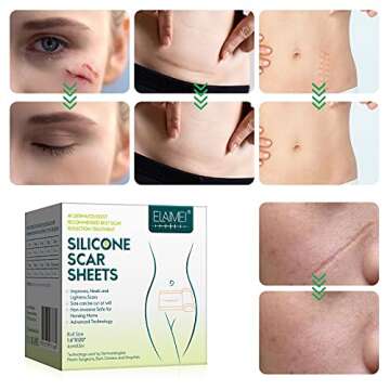Silicone Scar Sheets(1.6” x 120”), Large Roll Silicone Scar Tape - Professional Waterproof Soft Scar Strips for Acne Scars C-Section Keloid Surgery Burn Scars Skin Care, 10-12 Month Supply