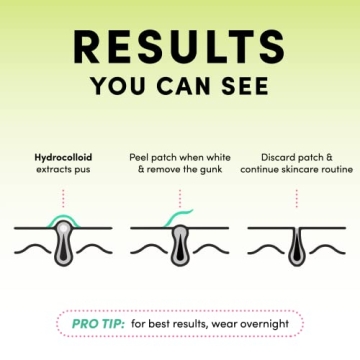 Dots for Spots Translucent Pimple Patches for Rapid Acne Relief