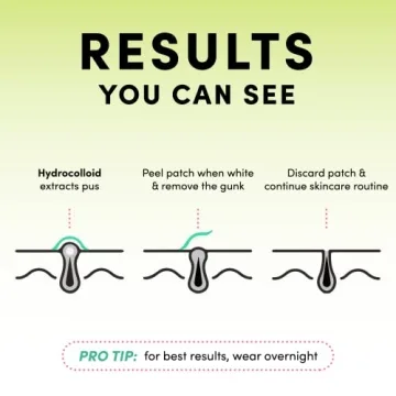 Dots for Spots Translucent Pimple Patches for Rapid Acne Relief