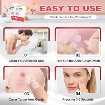 Hydrocolloid 216 Counts Pimple Patches for Acne Treatment