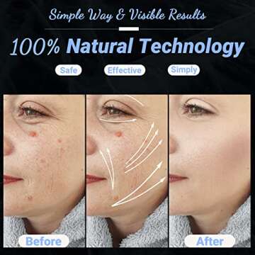 UUPAS 4 in 1 High Frequency Facial Wand for Home Use