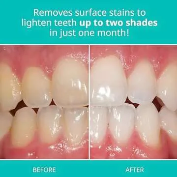 Opalescence Teeth Whitening Toothpaste Pack of 2 - Mint Flavor