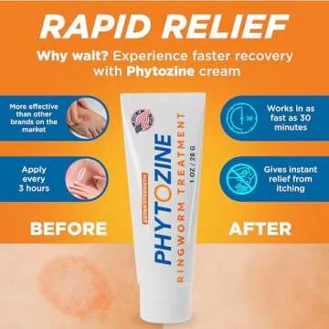 Phytozine - Extra Strength Antifungal Ringworm Treatment Cream for Humans - Powerful Antifungal Cream- Effective Athlete's Foot Treatment with Tolnaftate and Natural Oils for Adults and Kids (1 Ounce)