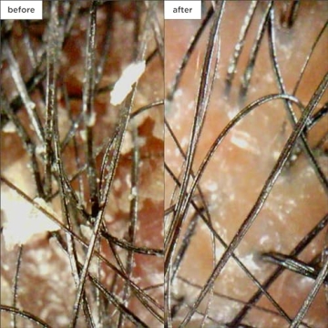 Briogeo Scalp Revival Minis Kit for Healthy Scalp