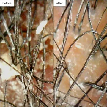 Briogeo Scalp Revival Minis Kit for Healthy Scalp