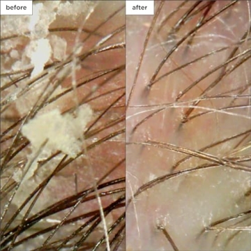 Briogeo Scalp Revival Minis Kit for Healthy Scalp