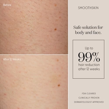 SmoothSkin Pure Fit IPL Hair Removal Device for Home Use