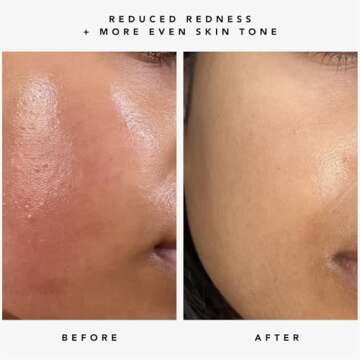 HERBIVORE Nova Brightening Serum for Face – 15% Vitamin C + Turmeric to Visibly Improve the Look of Dark Spots and Even Skin Tone, Plant-based, Vegan, Cruelty-free, 30mL /1 oz