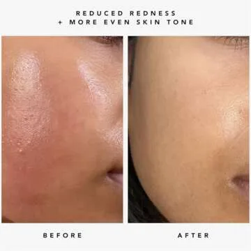 HERBIVORE Nova Brightening Serum for Face – 15% Vitamin C + Turmeric to Visibly Improve the Look of Dark Spots and Even Skin Tone, Plant-based, Vegan, Cruelty-free, 30mL /1 oz