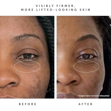 Bakuchiol Moon Fruit Serum for Smooth & Glowing Skin