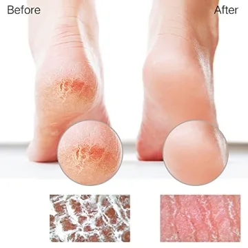 Sunivaca Glass Foot File Callus Remover for Perfect Feet