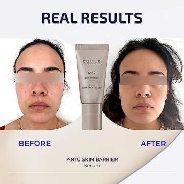 Hydrating Antü Skin Barrier Serum for All Skin Types | Codex Labs