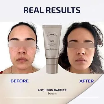 Hydrating Antü Skin Barrier Serum for All Skin Types | Codex Labs