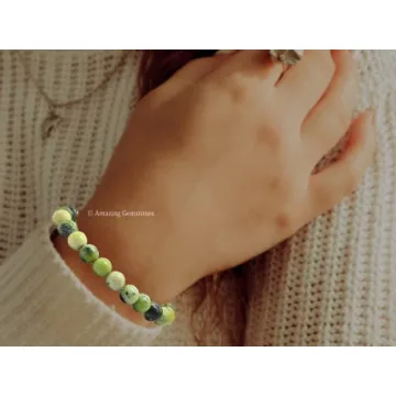 Amazing Chrysoprase Healing Crystal Bracelet for All