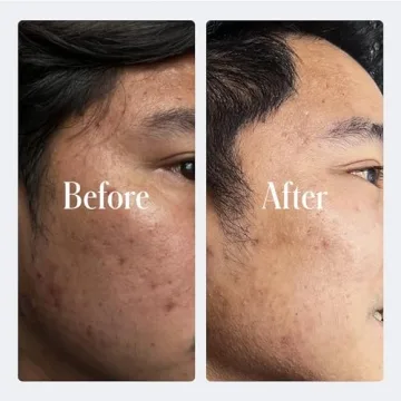 Geologie Retinol Night Cream for Youthful Radiance and Hydration