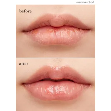 Nooni Korean Lip Butter Melt Balm - Hydrating Lip Mask