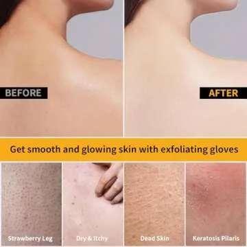 Sawnfay Exfoliating Gloves - Vegan Body Scrubber Set