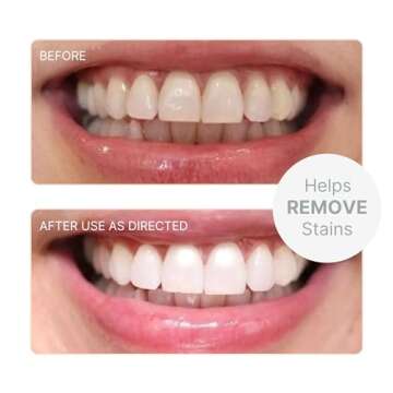 Nu Skin AP 24 Whitening Fluoride Toothpaste | 4oz | Brightens and Whitens Teeth | Helps Prevent Dent...