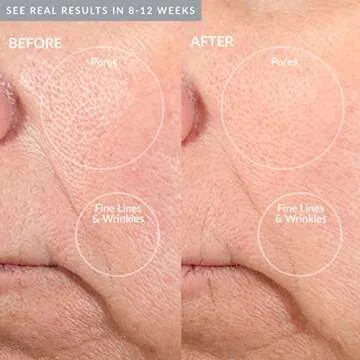 PMD Beauty Personal Microderm Pro - At-Home Microdermabrasion Machine with Kit for Face & Body - Exfoliating Crystals and Vacuum Suction for Fresh and Radiant Skin - High & Low Speed Options