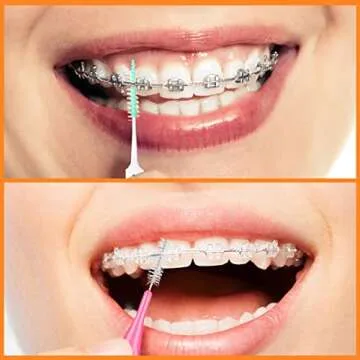 Zopeal 250 Pieces Interdental Brush Set for Bright Smiles