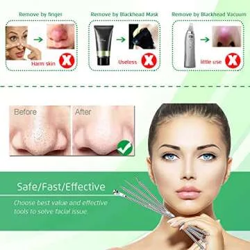 5PCS Blackhead Remover Comedone Extractor, Curved Blackhead Tweezers Kit, Professional Stainless Pim...