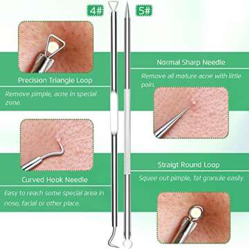 5PCS Blackhead Remover Comedone Extractor, Curved Blackhead Tweezers Kit, Professional Stainless Pimple Acne Blemish Removal Tools Kit