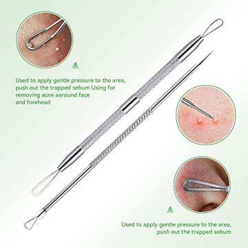 5 Pcs Pimple Popper Tool Kit for Clear Skin Solutions