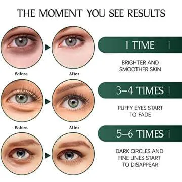 Tiepetly Under Eye Masks with Collagen and Green Tea