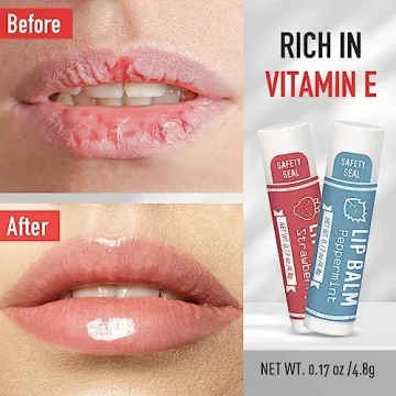 30 Pack Natural Lip Balm by AZEN | Moisturizing Care