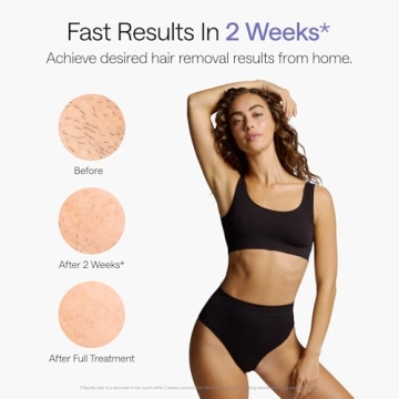 Ulike Air 10 IPL Hair Removal Device - Safe & Effective