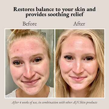 A | N Skin & Beauty Chlorophyll Correction Serum - Cruelty-Free Face Serum with Vitamin C, Hyaluronic Acid, and Hemp Seed Oil - Calming and Hydrating Serum for All Skin Types - 1 fl.oz