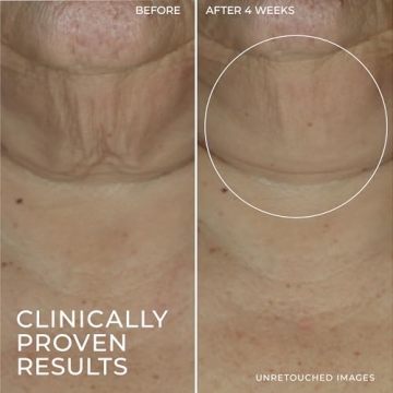 RoC Derm Correxion Retinol Firming Serum Stick for Youthful Skin