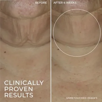 RoC Derm Correxion Retinol Firming Serum Stick for Youthful Skin