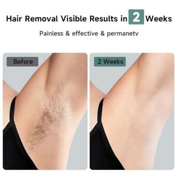 JOVS Laser Hair Removal, 37°F Painless Hair Removal Device with Sapphire Ice-Cooling, 3 in 1 Hair Removal & Skin Rejuvenation for Women and Men, 8 Modes Skin Care for Whole Body, Touch Screen