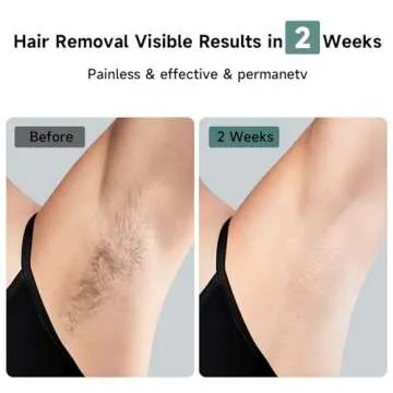 JOVS Laser Hair Removal, 37°F Painless Hair Removal Device with Sapphire Ice-Cooling, 3 in 1 Hair Removal & Skin Rejuvenation for Women and Men, 8 Modes Skin Care for Whole Body, Touch Screen