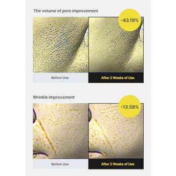 celimax The Vita A Retinol Shot Tightening Serum | with Pure Vitamin A Retinol, Peptide, Pore Minimizer, Wrinkles & Fine Lines, Firmer Skin, Anti-Aging, Skin Smoothing 30ml