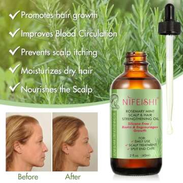 Bieyoc Rosemary Essential Oil for Hair Growth, Hair & Skin Care - Strengthens Hair, Stimulates Growt...