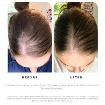 Dr. Groot Hair Thickening Shampoo, Korean Hair Care with Biotin, Rosemary Oil to help Volumize Thinning, Damaged Hair, Hydrate Hair and Scalp, Biotin Shampoo,Scalp Revitalizing Solution