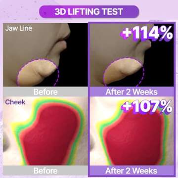 Probioderm™ 3D Lifting Full Face Tension Gel Mask | NOT a Hydrating Mask – Firming & Tightening for Lifted, Sculpted Skin | 20-Peptide Complex & PDRN for Face Contouring & Jawline Definition