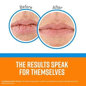 O'Keeffe's Cooling Relief Lip Repair Lip Balm for Dry, Cracked Lips, Stick, (Pack of 3)