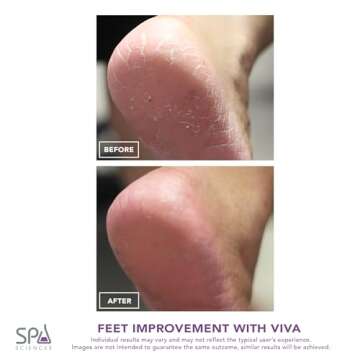 Spa Sciences Viva Pedicure Tool for Smooth Feet